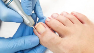 Why Ingrown Toenails Happen: Common Causes You Should Know