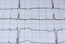 maximize online pulse lens